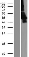 LDHD Human Over-expression Lysates NM_194436