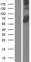 ls197322 acsf3 human over expression lysates nm 001127214 wb testing 1