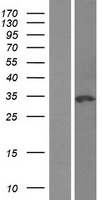 NSMCE1 Human Over-expression Lysates NM_145080