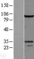 DZIP1L Human Over-expression Lysates NM_173543