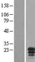 MCEMP1 Human Over-expression Lysates NM_174918