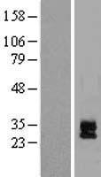 DAND5 Human Over-expression Lysates NM_152654