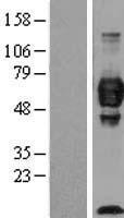 Cell adhesion molecule 4 (CADM4) Human Over-expression Lysates NM_145296