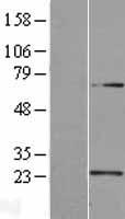 U2AF1L3 (U2AF1L4) Human Over-expression Lysates NM_144987