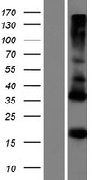 ADM5 Human Over-expression Lysates NM_001101340