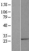 ls199857 alg14 human over expression lysates nm 144988 wb testing 1