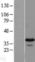 ls199870 fam76a human over expression lysates nm 152660 wb testing 2