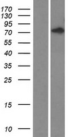 ls199920 fyb2 human over expression lysates nm 001004303 wb testing 1