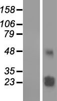 TMEM61 Human Over-expression Lysates NM_182532