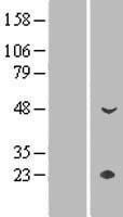 CYP4Z1 Human Over-expression Lysates NM_178134