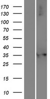 NUDT17 Human Over-expression Lysates NM_001012758