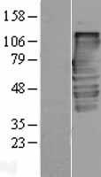 Alpha Taxilin (TXLNA) Human Over-expression Lysates NM_175852