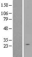 ls200132 tctex1d1 human over expression lysates nm 152665 wb testing 1