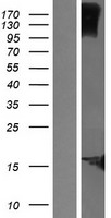 KRTCAP2 Human Over-expression Lysates NM_173852