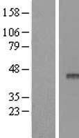 APOBEC3F Human Over-expression Lysates NM_145298