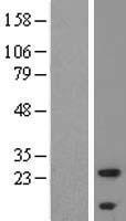 ALMS1P1 Human Over-expression Lysates NM_145300