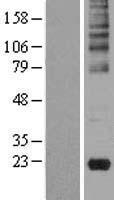 Gastrokine 2 (GKN2) Human Over-expression Lysates NM_182536