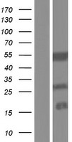 KRTCAP3 Human Over-expression Lysates NM_001168364