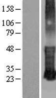 KRTCAP3 Human Over-expression Lysates NM_173853
