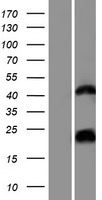 HCG1657980 (LOC200726) Human Over-expression Lysates NM_001102659