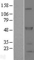 SPRED2 Human Over-expression Lysates NM_181784