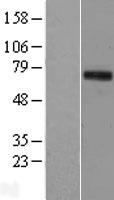 ls200765 tigd1 human over expression lysates nm 145702 wb testing 1
