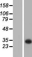 KCTD6 Human Over-expression Lysates NM_001128214