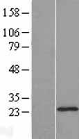 ls200895 dhfrl1 dhfr2 human over expression lysates nm 176815 wb testing 1