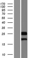 CCDC46 (CEP112) Human Over-expression Lysates NM_001037325