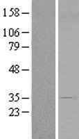 ls201161 prr6 cenpv human over expression lysates nm 181716 wb testing 1