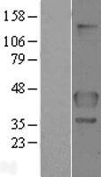 FLCN Human Over-expression Lysates NM_144606