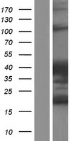 SH3D20 (ARHGAP27) Human Over-expression Lysates NM_174919