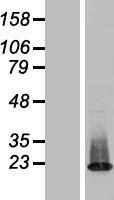 ZNF385C Human Over-expression Lysates NM_001013624