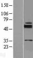 ls201266 slc39a11 human over expression lysates nm 139177 wb testing 1