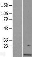 C4orf46 Human Over-expression Lysates NM_001008393