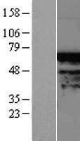 TIGD4 Human Over-expression Lysates NM_145720