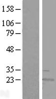 RWDD4A (RWDD4) Human Over-expression Lysates NM_152682
