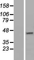 DNAJC18 Human Over-expression Lysates NM_152686