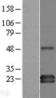 GAPT Human Over-expression Lysates NM_152687