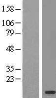 OSTCP1 Human Over-expression Lysates NM_145303