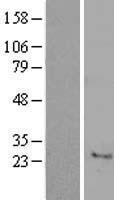 ls202865 c7orf33 human over expression lysates nm 145304 wb testing 1