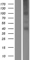 TMEM184A Human Over-expression Lysates NM_001097620