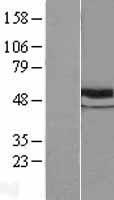 beta V Tubulin (TUBB) Human Over-expression Lysates NM_178014