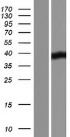 PRSS55 Human Over-expression Lysates NM_001197020