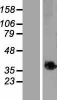 C9ORF91 (TMEM268) Human Over-expression Lysates NM_153045