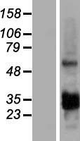 ls203260 ccdc107 human over expression lysates nm 174923 wb testing 1