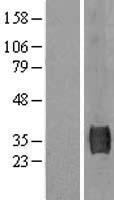 SUSD3 Human Over-expression Lysates NM_145006