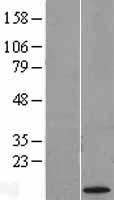 ls203413 kk lc 1 ct83 human over expression lysates nm 001017978 wb testing 1
