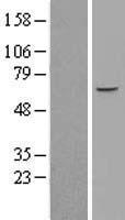ZNF449 Human Over-expression Lysates NM_152695