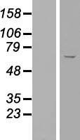 ls203611 cdy2b human over expression lysates nm 001001722 wb testing 1